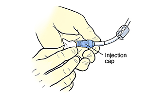 Closeup of gloved hands cleaning injection cap of central line with alcohol wipe.